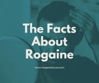 The Facts About Rogaine