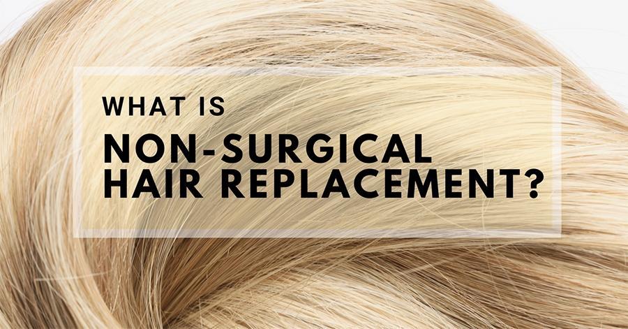 What is Non-Surgical Hair Replacement?